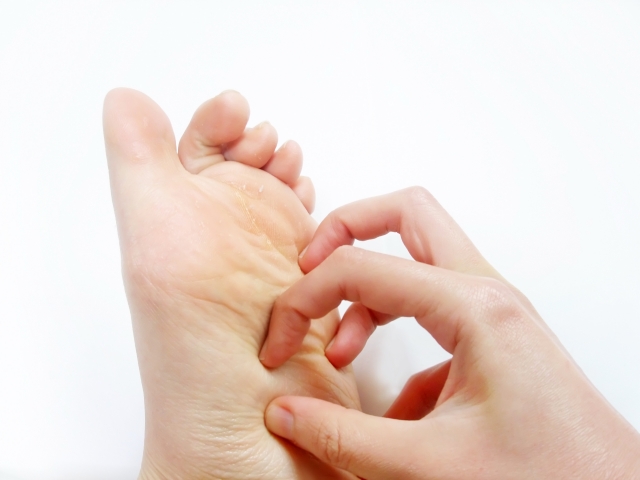 【皮膚科監修】足の裏が痒い…その原因、本当に水虫ですか？